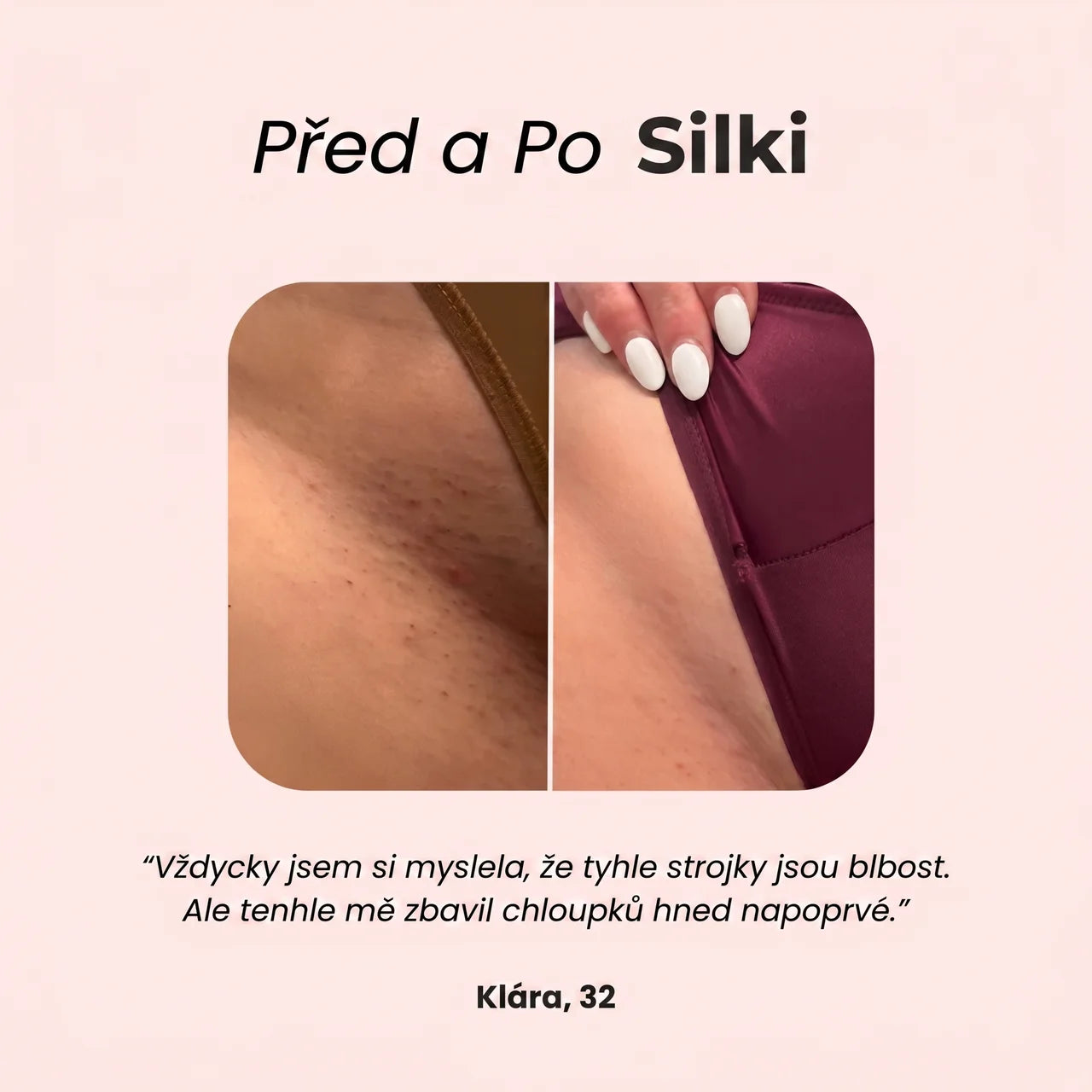 Silki 2.0 – Bikini holicí strojek